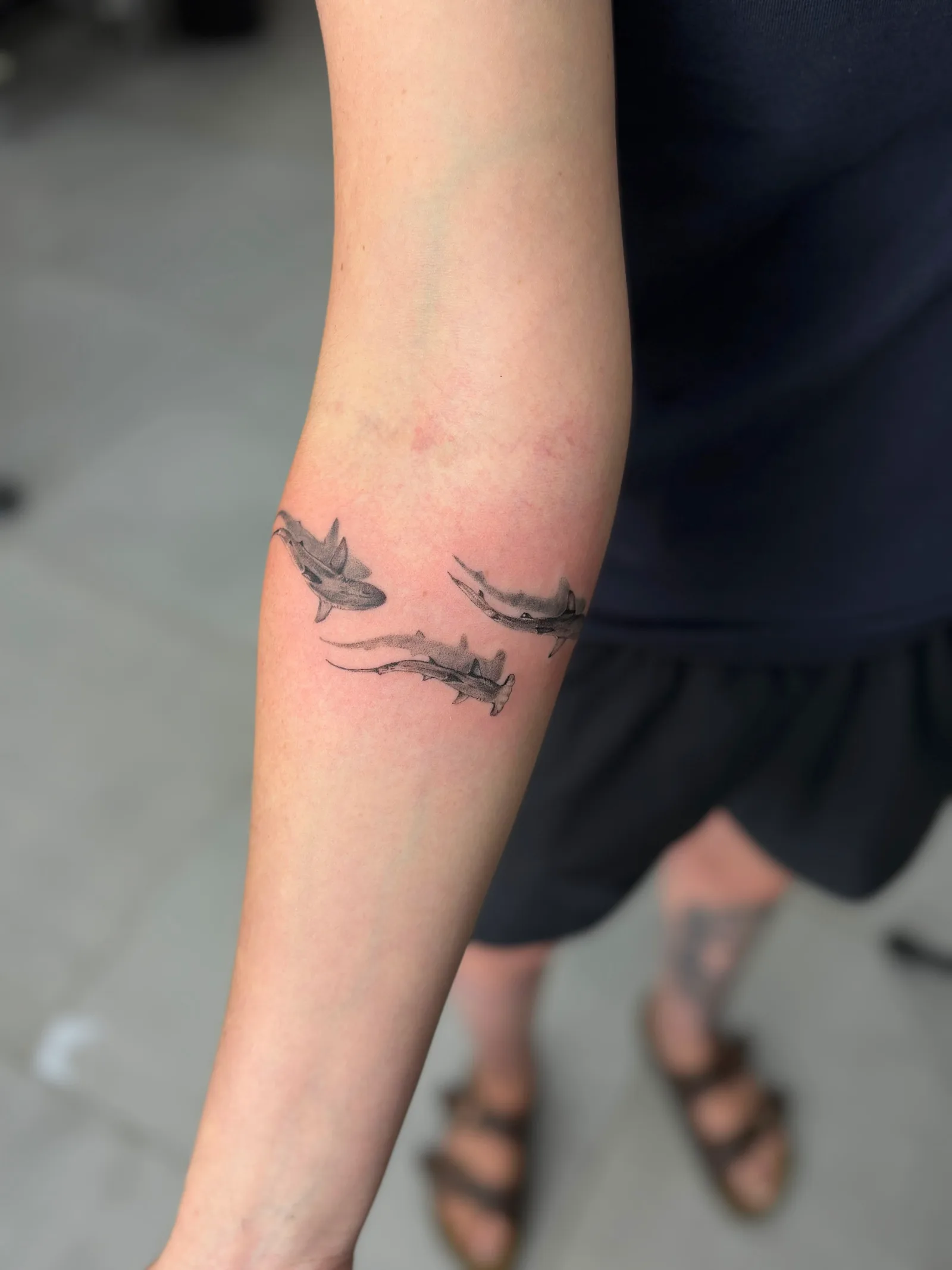 fine line on the arm