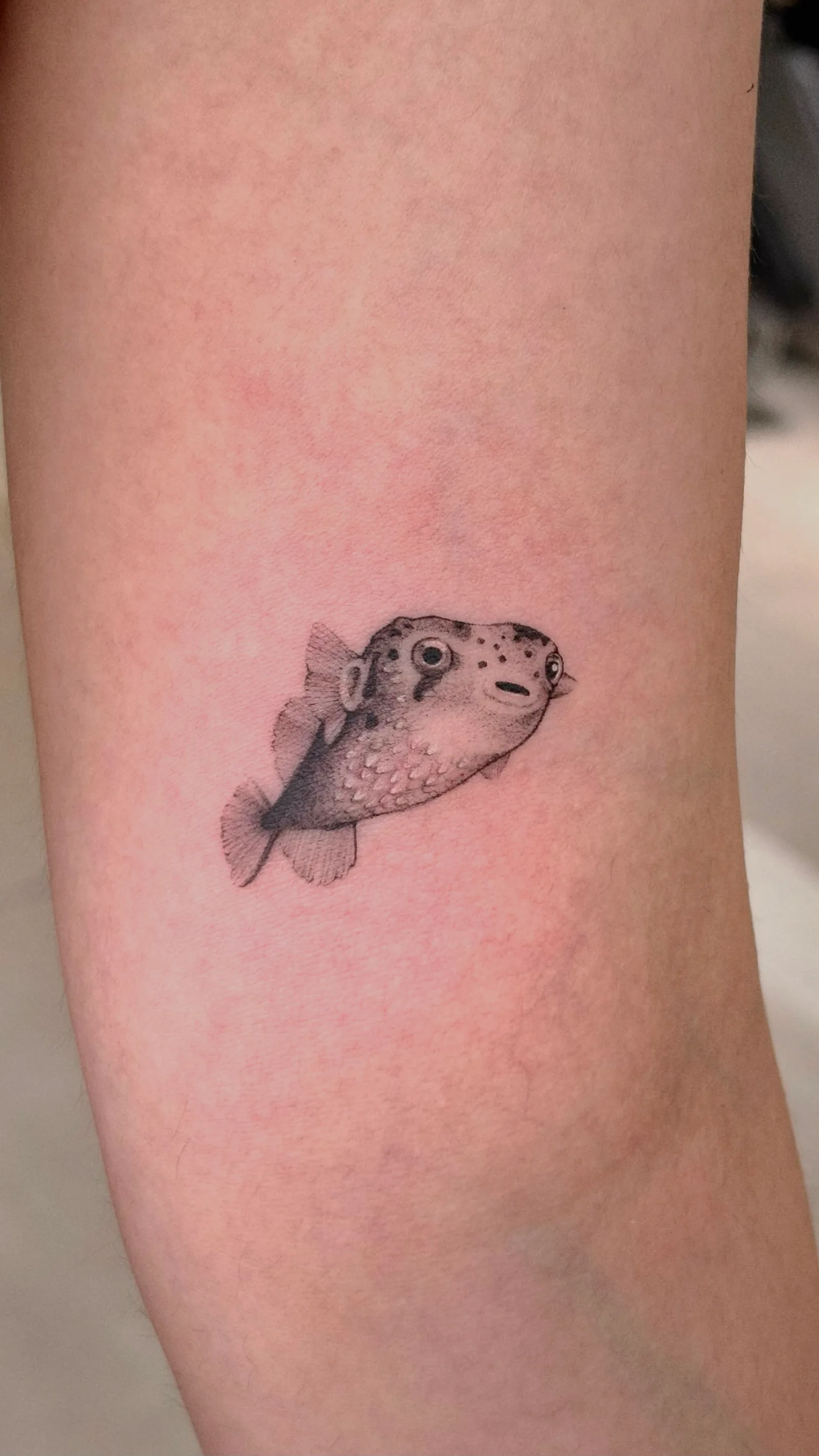 fine line on the arm