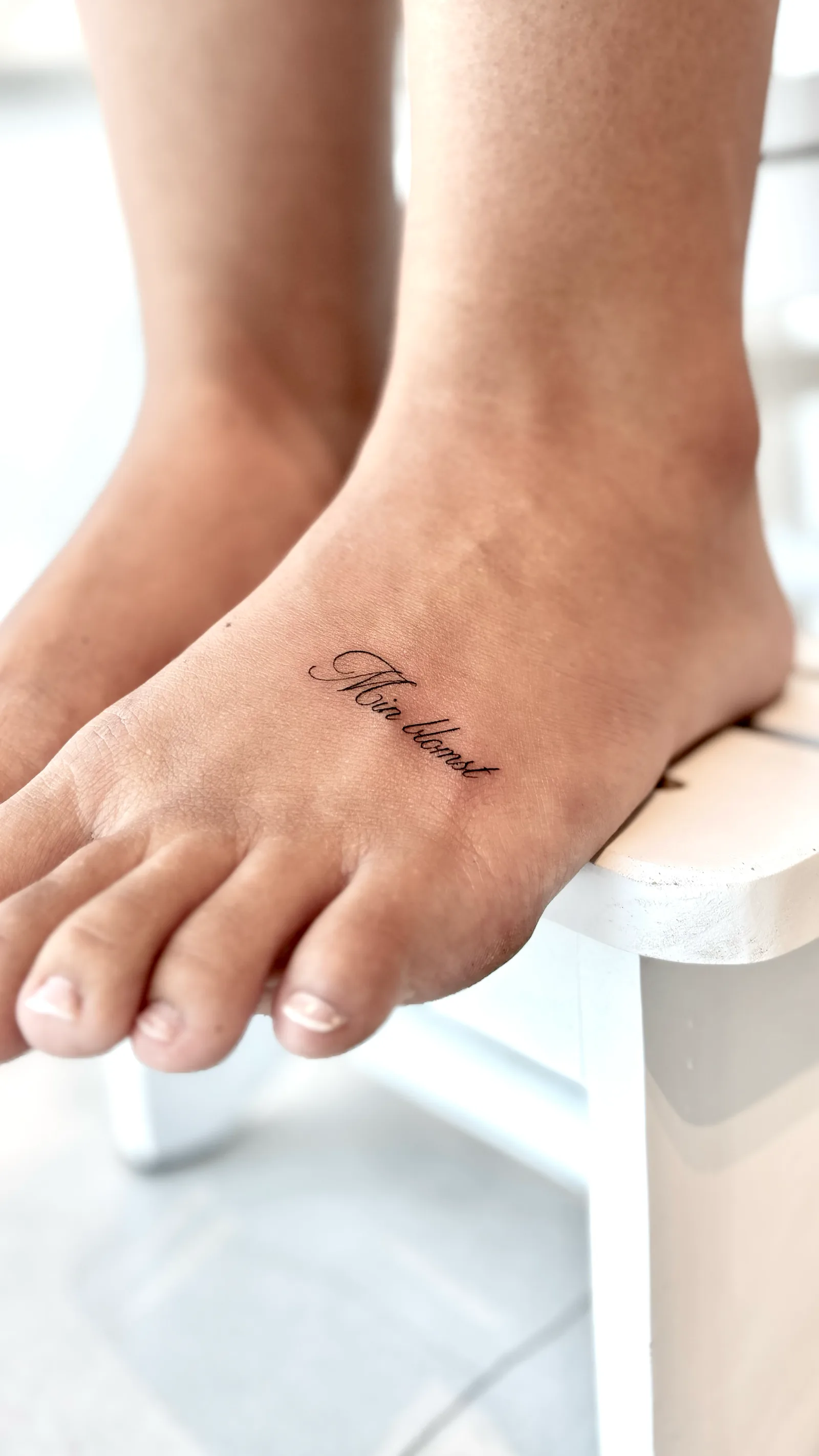 fine line on the arm