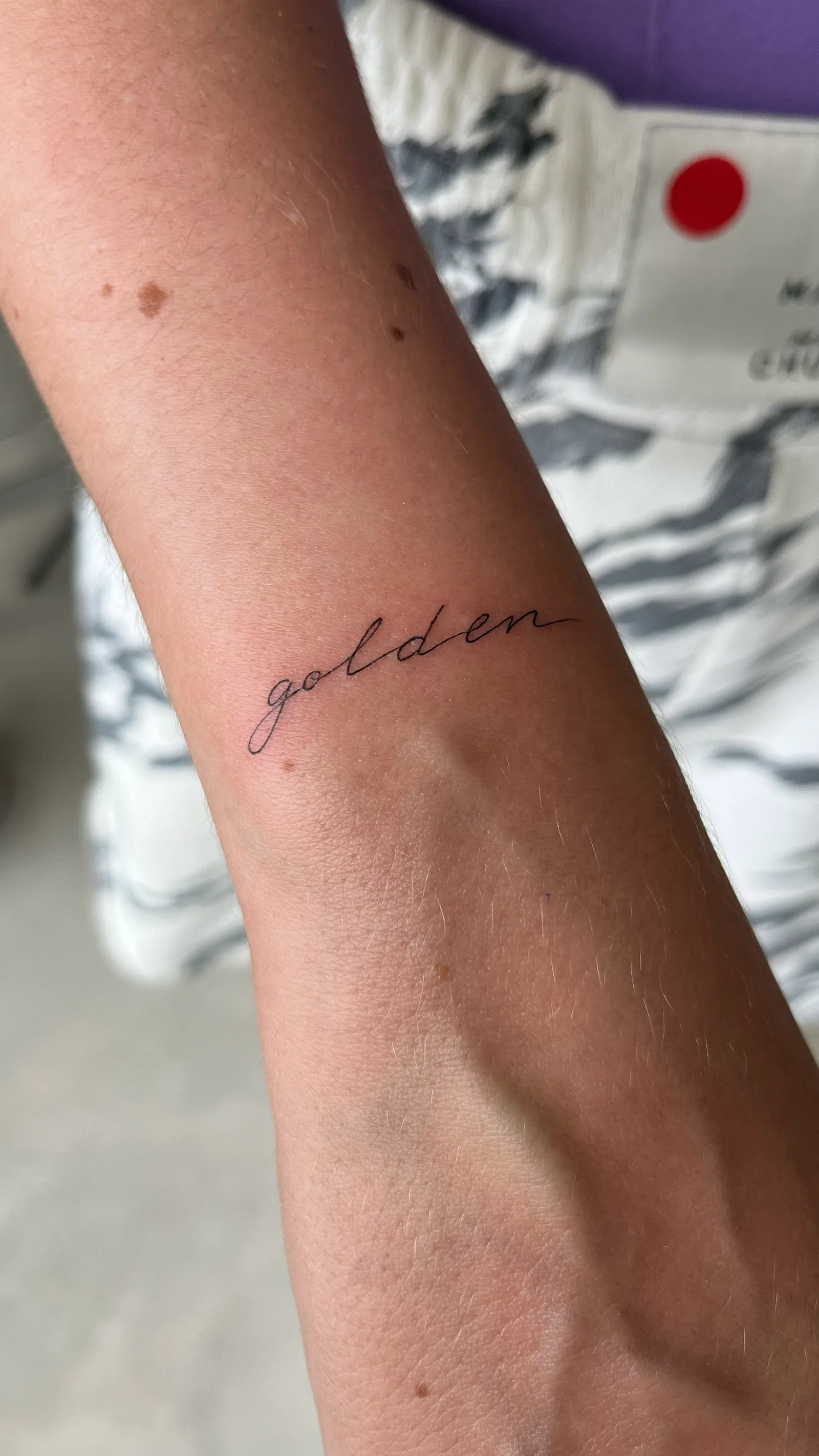 fine line on the arm
