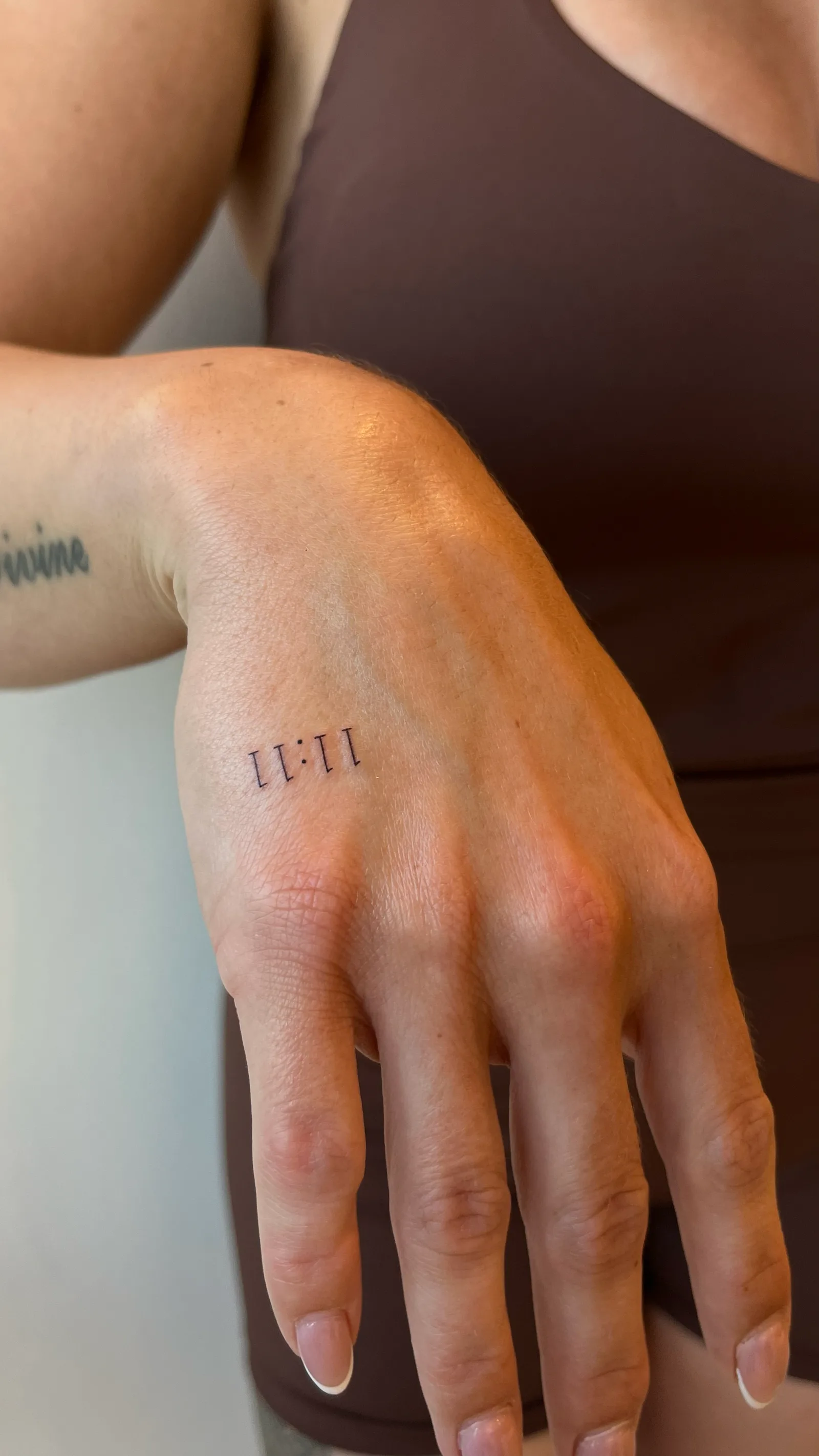 fine line on the arm