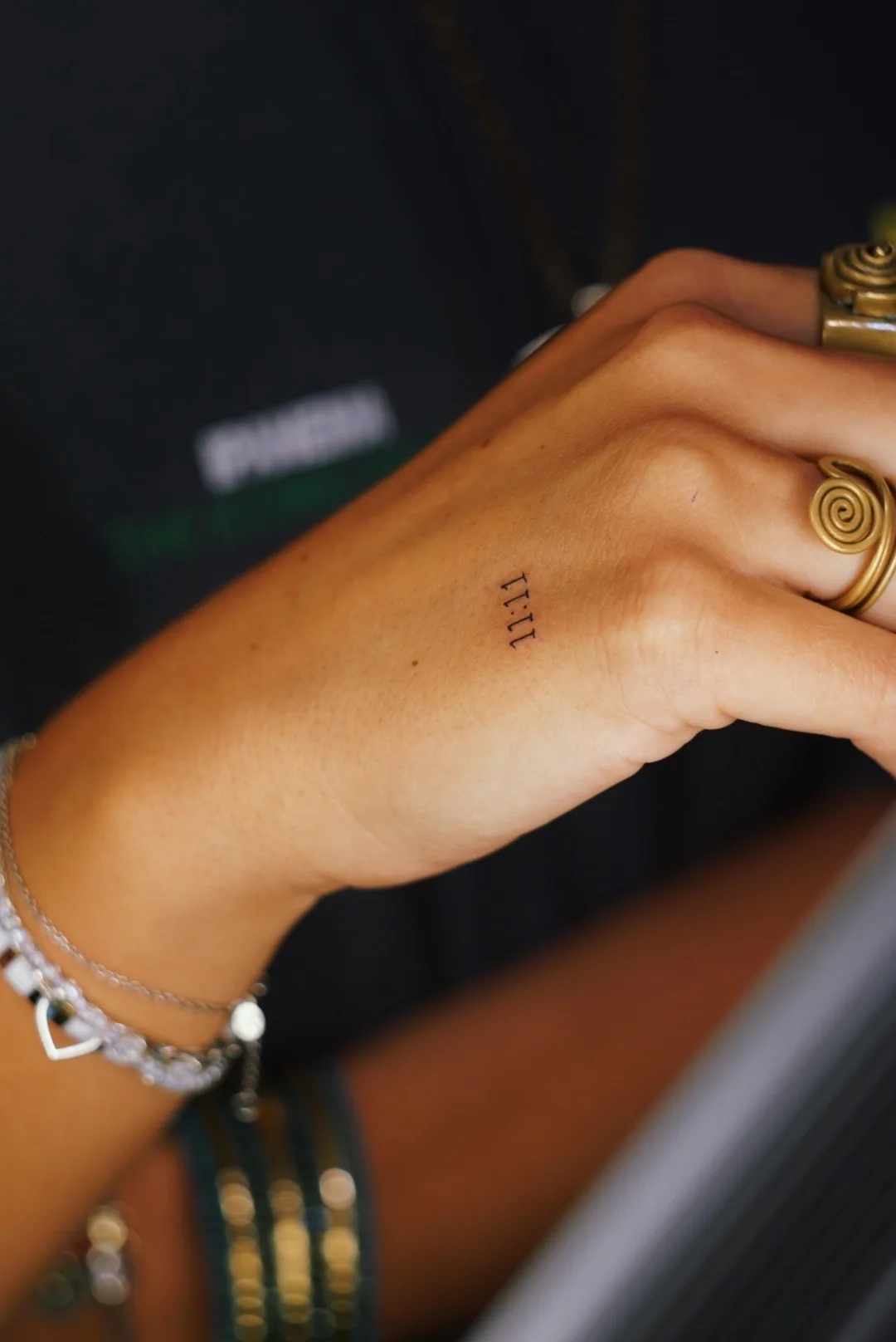 fine line on the arm