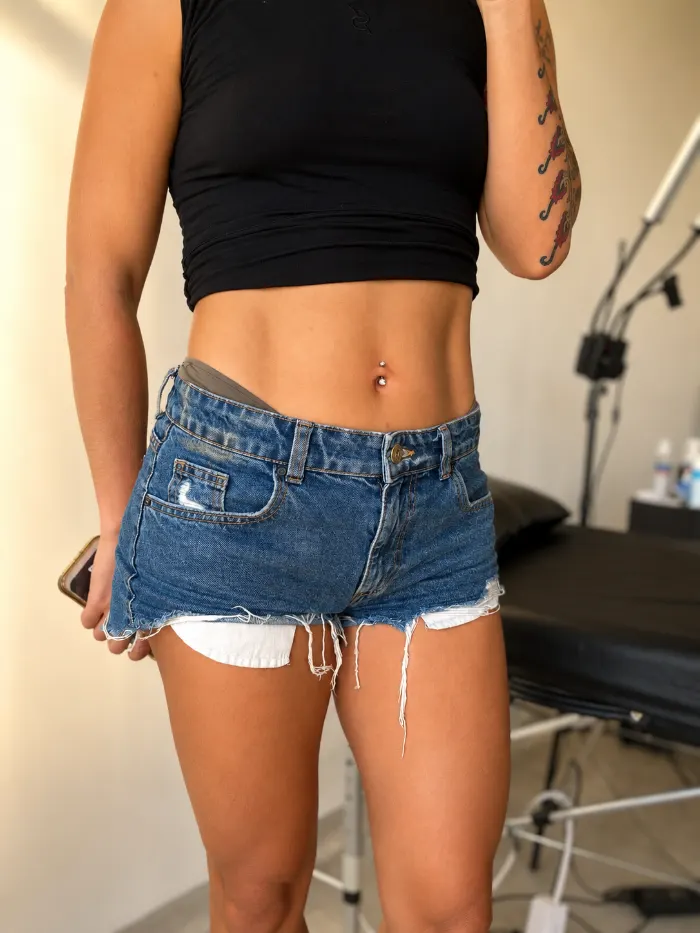 Navel piercing healed on a client