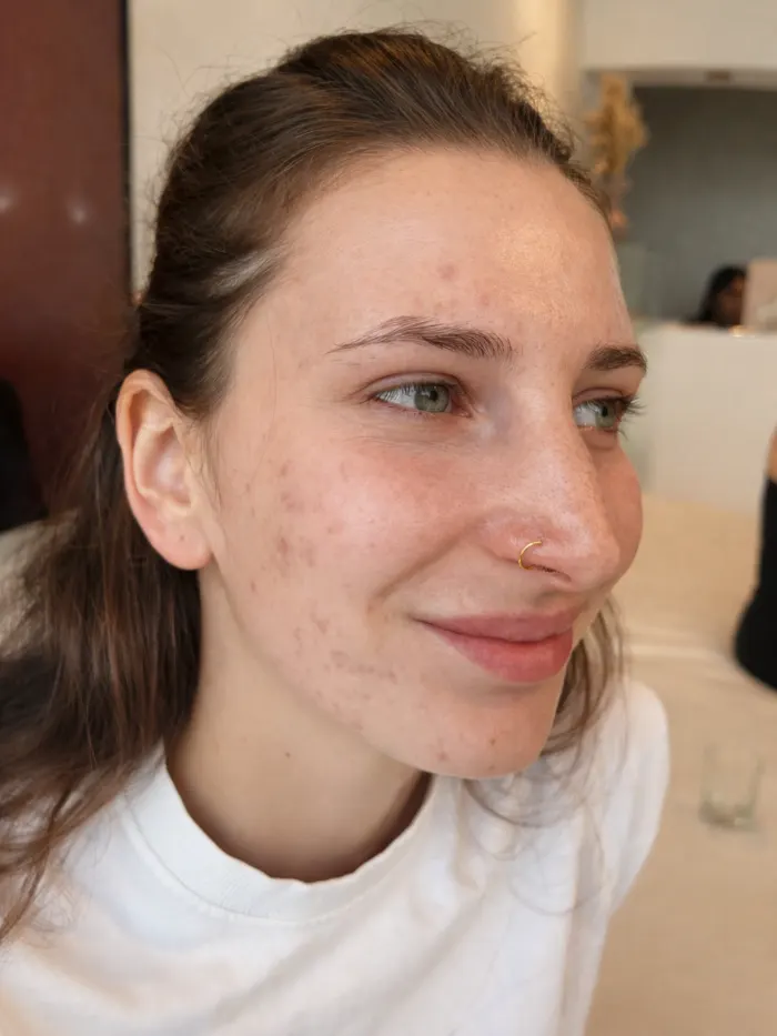 Nostril piercing healed on a client